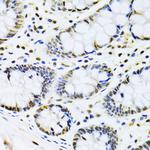 CBX8 Antibody in Immunohistochemistry (Paraffin) (IHC (P))