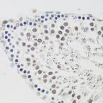 Cyclin E2 Antibody in Immunohistochemistry (Paraffin) (IHC (P))