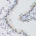 Cyclin E2 Antibody in Immunohistochemistry (Paraffin) (IHC (P))