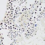 Cyclin E2 Antibody in Immunohistochemistry (Paraffin) (IHC (P))