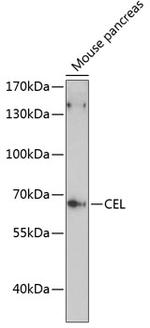 CEL Antibody in Western Blot (WB)