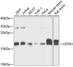 CETN1 Antibody in Western Blot (WB)