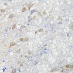 CHIC2 Antibody in Immunohistochemistry (Paraffin) (IHC (P))