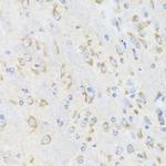 CHIC2 Antibody in Immunohistochemistry (Paraffin) (IHC (P))