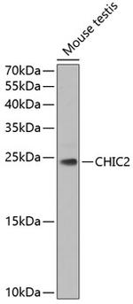 CHIC2 Antibody in Western Blot (WB)