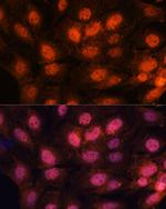 CHTF18 Antibody in Immunocytochemistry (ICC/IF)