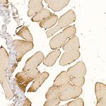 CLCN1 Antibody in Immunohistochemistry (Paraffin) (IHC (P))