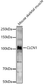 CLCN1 Antibody in Western Blot (WB)