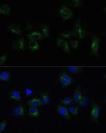 CLTB Antibody in Immunocytochemistry (ICC/IF)