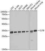 CLTB Antibody in Western Blot (WB)