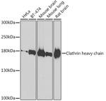 CLTC Antibody in Western Blot (WB)