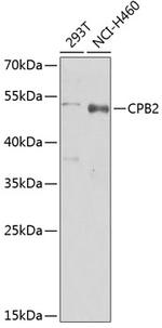 CPB2 Antibody in Western Blot (WB)