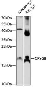 CRYGB Antibody in Western Blot (WB)