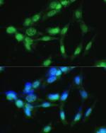 CSNK2A2 Antibody in Immunocytochemistry (ICC/IF)