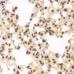 CSNK2A2 Antibody in Immunohistochemistry (Paraffin) (IHC (P))