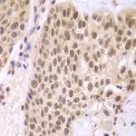 CSNK2A2 Antibody in Immunohistochemistry (Paraffin) (IHC (P))