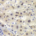 CSNK2A2 Antibody in Immunohistochemistry (Paraffin) (IHC (P))