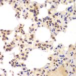 CSNK2A2 Antibody in Immunohistochemistry (Paraffin) (IHC (P))