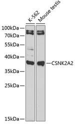 CSNK2A2 Antibody in Western Blot (WB)