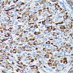 CYP11A1 Antibody in Immunohistochemistry (Paraffin) (IHC (P))