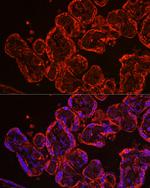 CYP11A1 Antibody in Immunohistochemistry (Paraffin) (IHC (P))