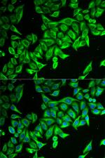 DAP Antibody in Immunocytochemistry (ICC/IF)