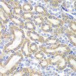 DAP Antibody in Immunohistochemistry (Paraffin) (IHC (P))