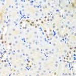 DDX39A Antibody in Immunohistochemistry (Paraffin) (IHC (P))