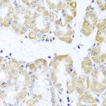 DDX39A Antibody in Immunohistochemistry (Paraffin) (IHC (P))