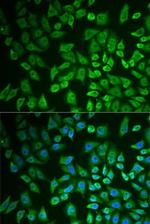 DDX41 Antibody in Immunocytochemistry (ICC/IF)