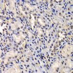 DDX41 Antibody in Immunohistochemistry (Paraffin) (IHC (P))