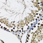 DDX41 Antibody in Immunohistochemistry (Paraffin) (IHC (P))