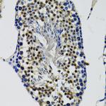 DDX41 Antibody in Immunohistochemistry (Paraffin) (IHC (P))