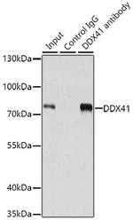 DDX41 Antibody in Immunoprecipitation (IP)