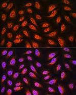 PNPO Antibody in Immunocytochemistry (ICC/IF)