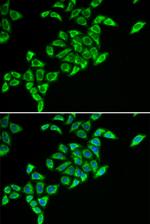 DLAT Antibody in Immunocytochemistry (ICC/IF)