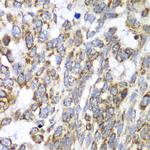 DLST Antibody in Immunohistochemistry (Paraffin) (IHC (P))