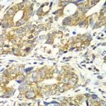 DLST Antibody in Immunohistochemistry (Paraffin) (IHC (P))