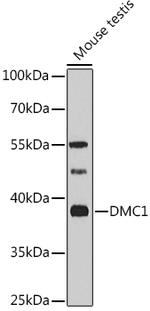 DMC1 Antibody in Western Blot (WB)