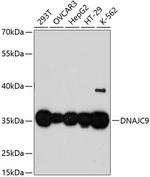 DNAJC9 Antibody in Western Blot (WB)