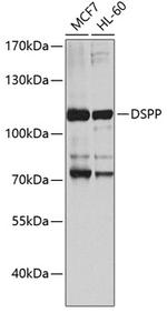 DSPP Antibody in Western Blot (WB)