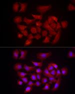 DUSP8 Antibody in Immunocytochemistry (ICC/IF)