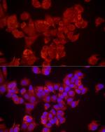 DUSP8 Antibody in Immunocytochemistry (ICC/IF)