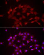 DUSP8 Antibody in Immunocytochemistry (ICC/IF)