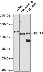 EphA3 Antibody in Western Blot (WB)