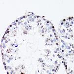 FGF12 Antibody in Immunohistochemistry (Paraffin) (IHC (P))