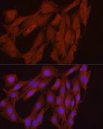 FGF17 Antibody in Immunocytochemistry (ICC/IF)