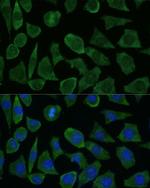 FKBP1B Antibody in Immunocytochemistry (ICC/IF)