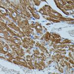 FKBP1B Antibody in Immunohistochemistry (Paraffin) (IHC (P))