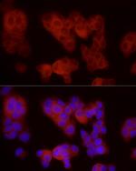 FLT4 Antibody in Immunocytochemistry (ICC/IF)